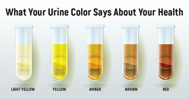 different colours of urine and their meaning        <h3 class=